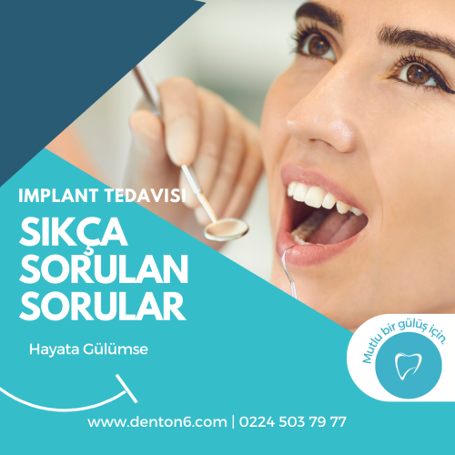 sikca sorulan sorular - implant tedavisi - denton6