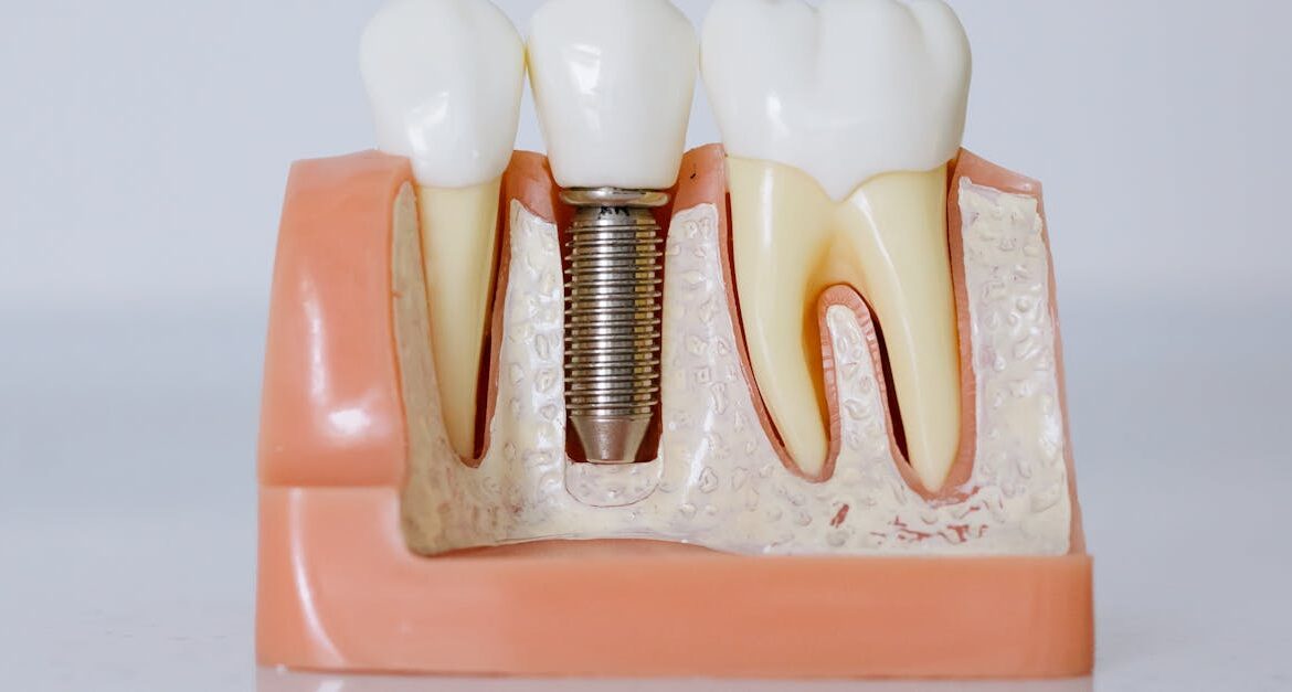 Megagen Implant iyi Mi 10eea79285f4a6c35d29041f8a745753