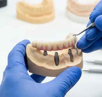 Bursa Yıldırım All-on-4 ve All-on-6 İmplant: Tek Günde Yeni Dişler (2026)