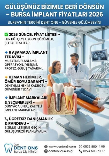 Yazılar Bursa İmplant Fiyatları 2026