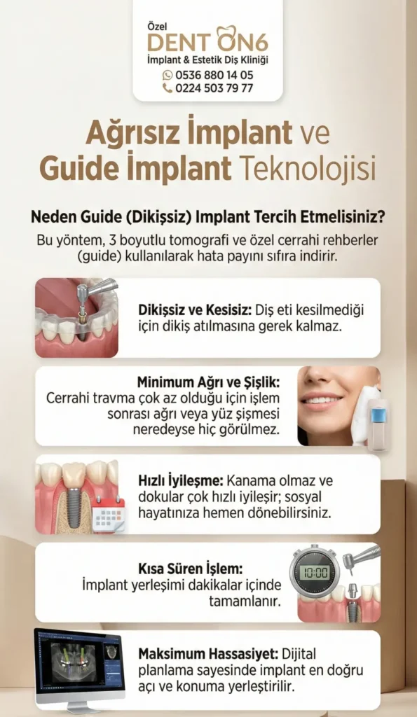 Yazılar Bursa’da Ağrısız ve Dikişsiz İmplant Konforu: Guide Implant Teknolojisi