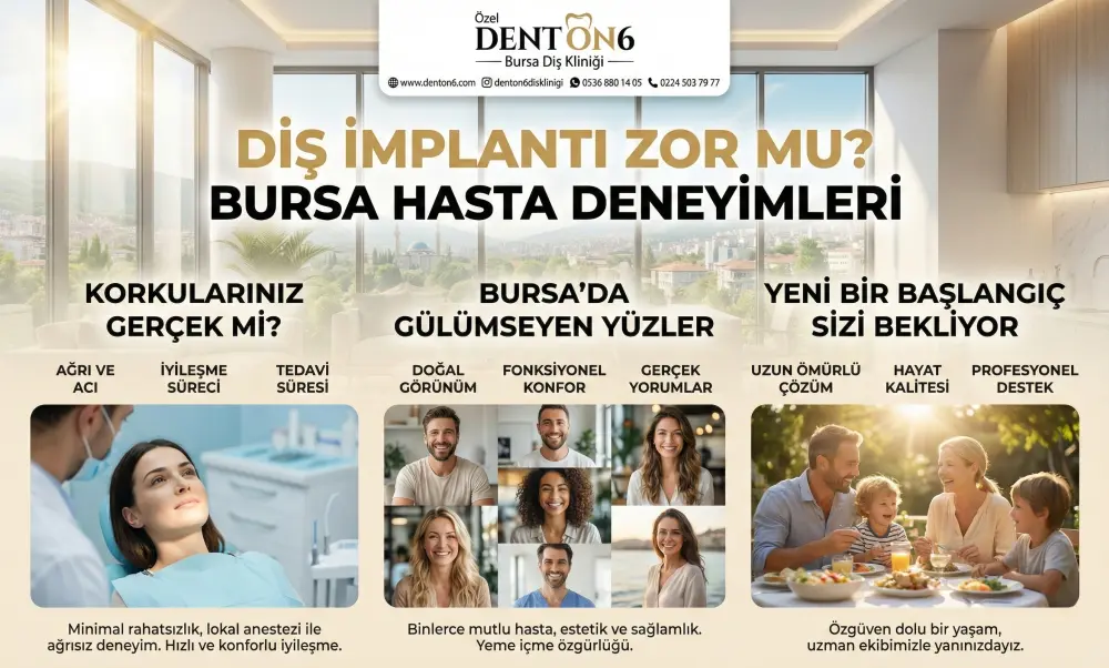Bursa Vidalı Diş İmplant Yorumları