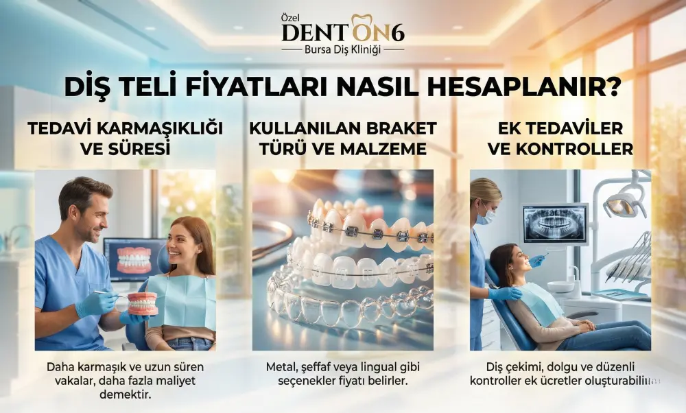 Bursa Diş Teli Fiyat Hesaplama