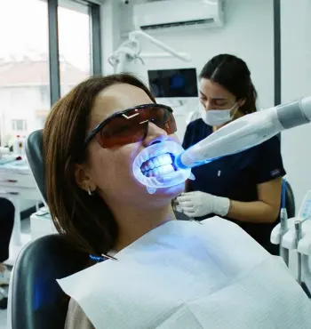 Bursa Yıldırım Beyazlatma