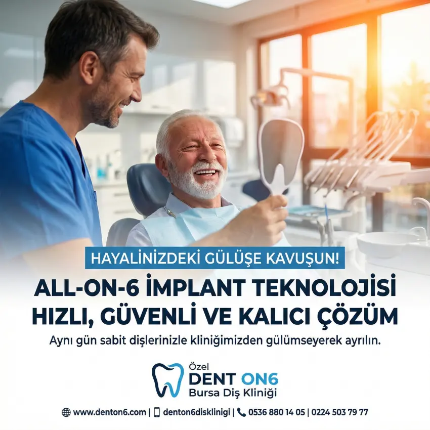 Bursa tüm ağız implant