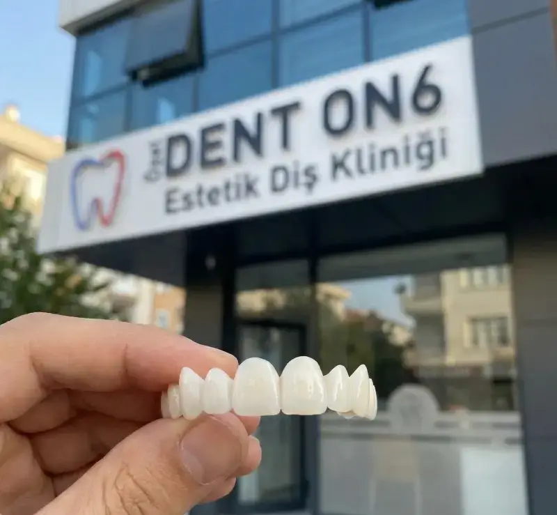 Yazılar Geçici Dişler Çok Çirkin